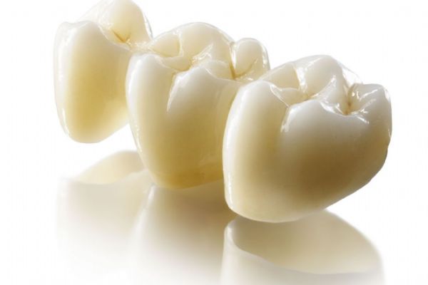 Krbec Dent nabízí špičkové vybavení zubařských ordinací a materiály nové generace – bredent BioHPP