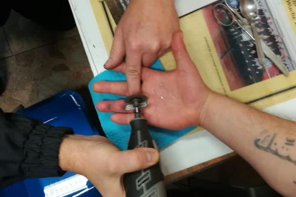 Kraslicko: Hasiči pomohli odstranit prstýnek z oteklého prstu